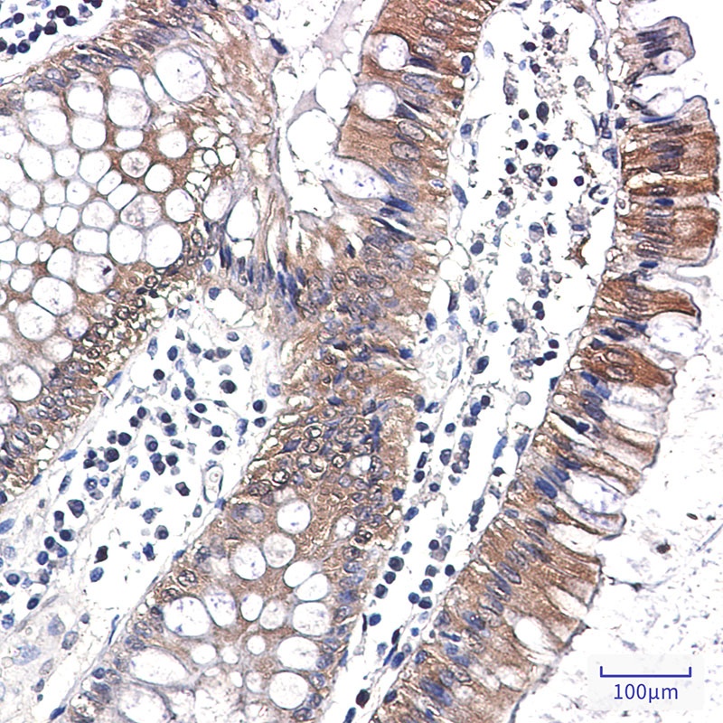 Caspase 7 Rabbit Monoclonal Antibody