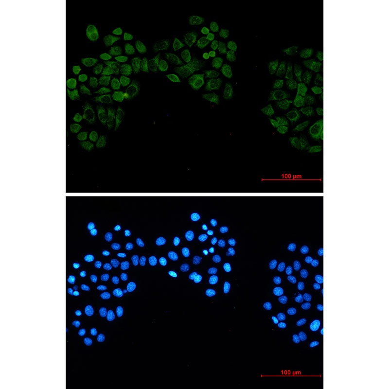 Casein Kinase 2 beta Rabbit Monoclonal Antibody