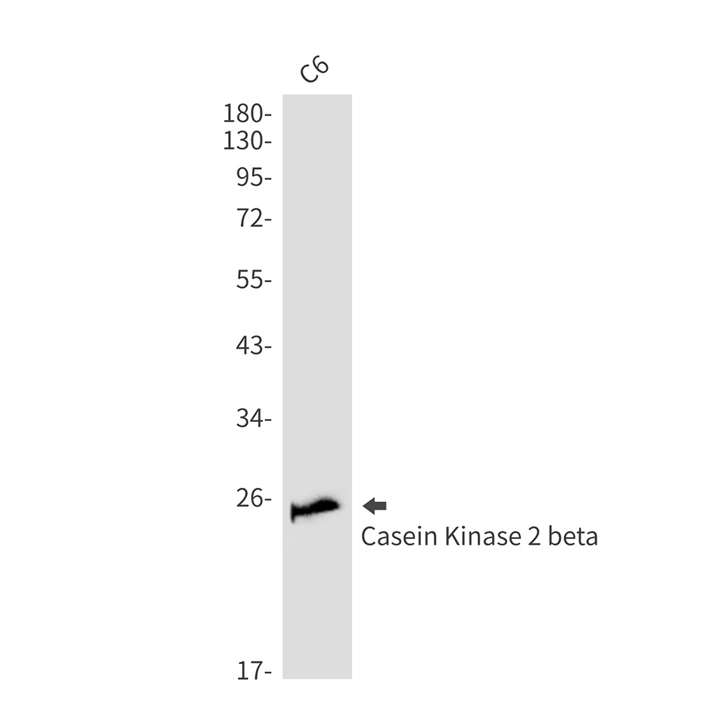 Casein Kinase 2 beta Rabbit Monoclonal Antibody