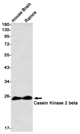 Casein Kinase 2 beta Rabbit Monoclonal Antibody