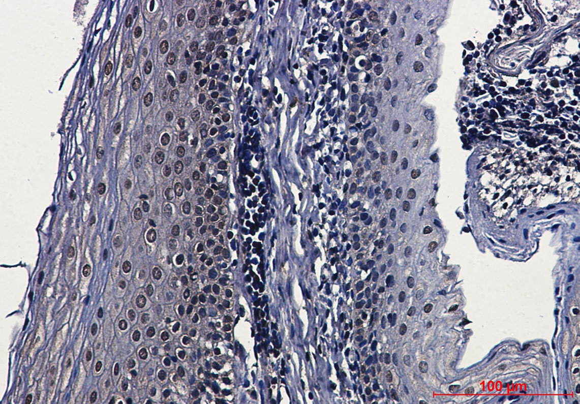 Casein Kinase 2 beta Rabbit Monoclonal Antibody