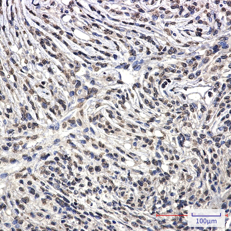 BCR Antibody