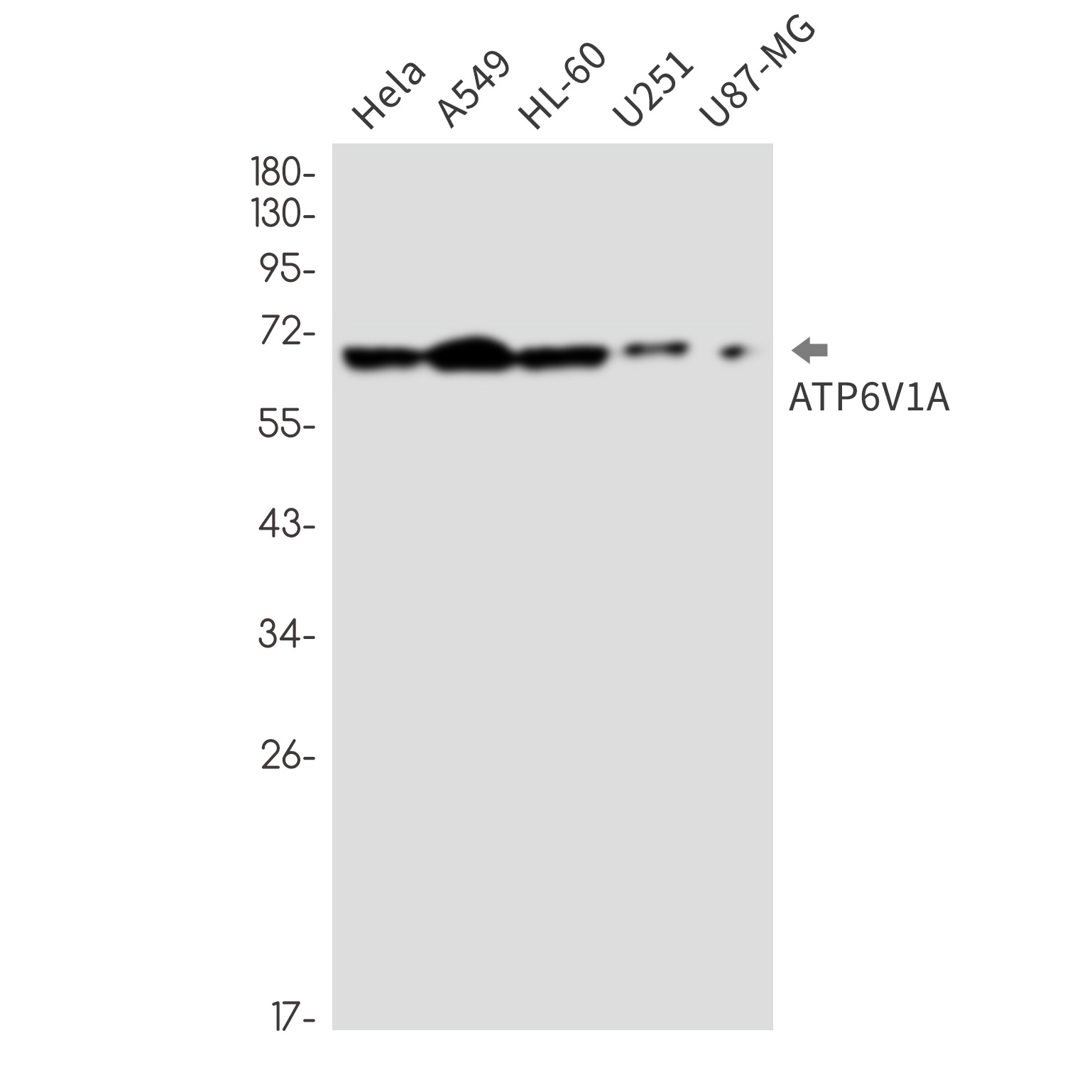 ATP6V1A Antibody