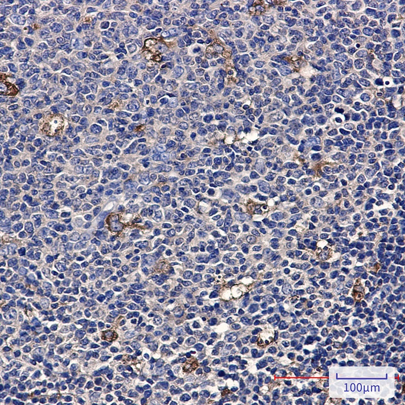 ATP6V1A Antibody
