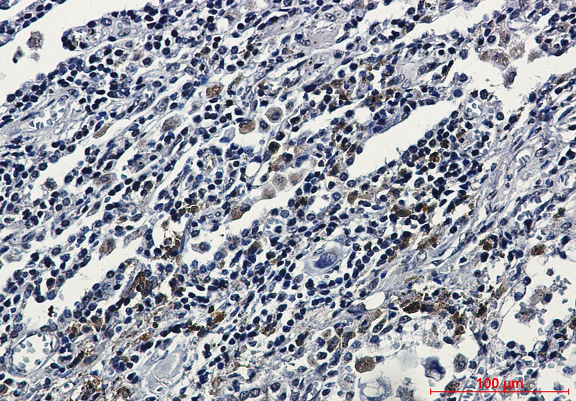 ATF6 Antibody