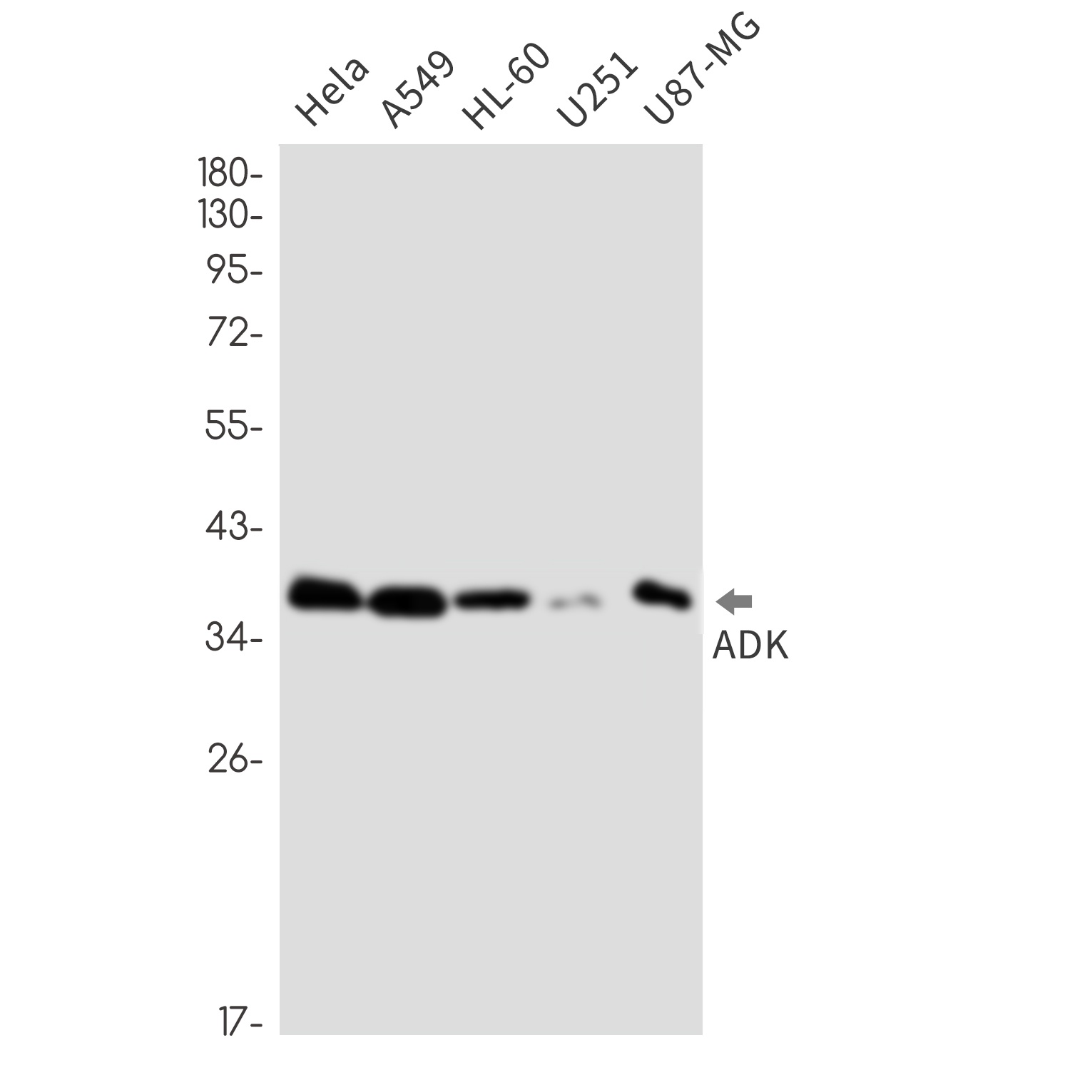 ADK Antibody
