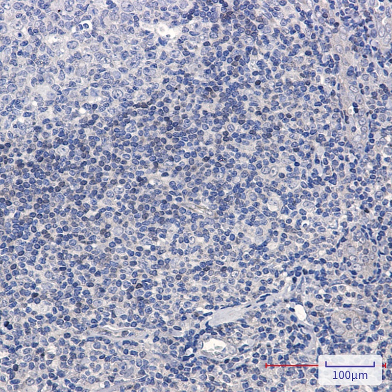 ADK Antibody
