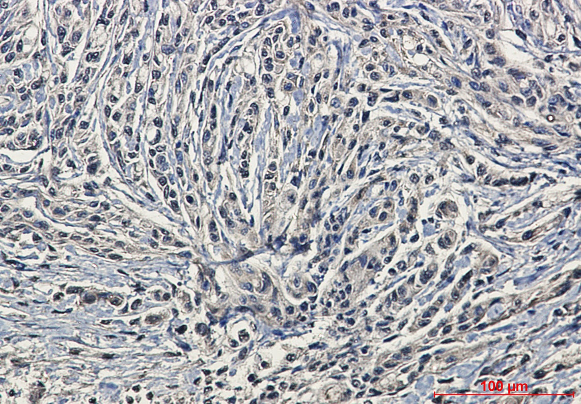 PRKCA Antibody