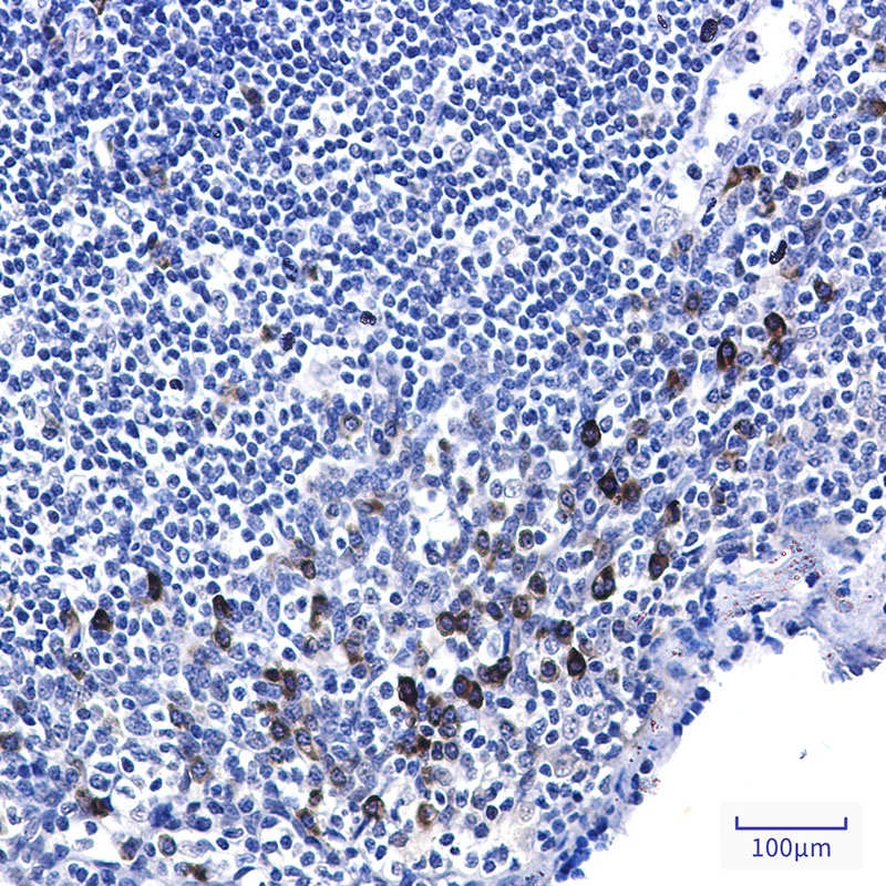 TP53 Antibody