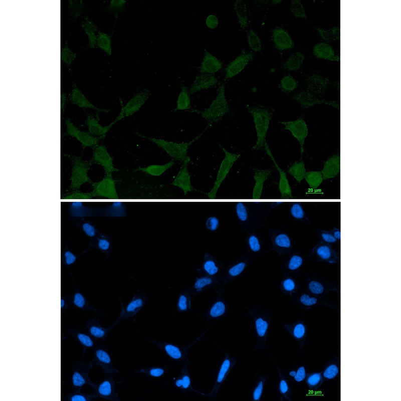 NDRG1 Antibody