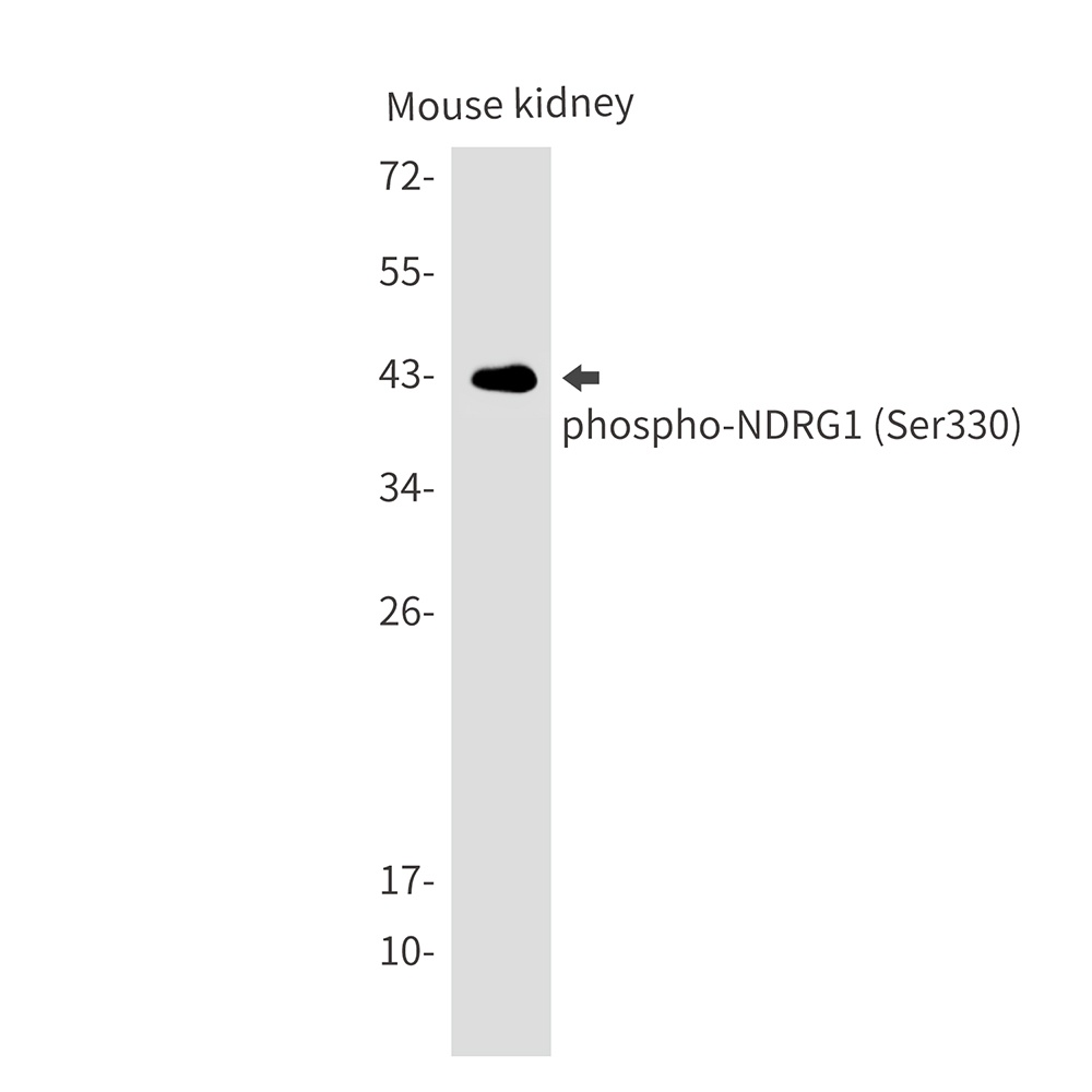 NDRG1 Antibody