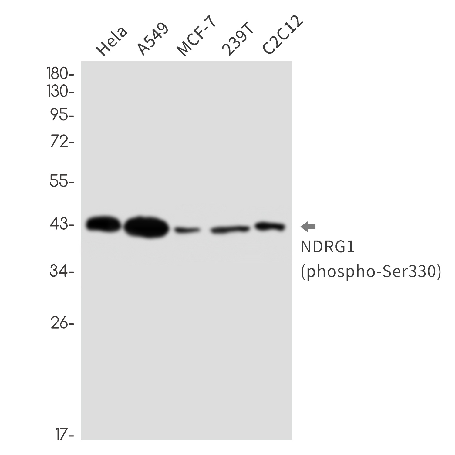 NDRG1 Antibody