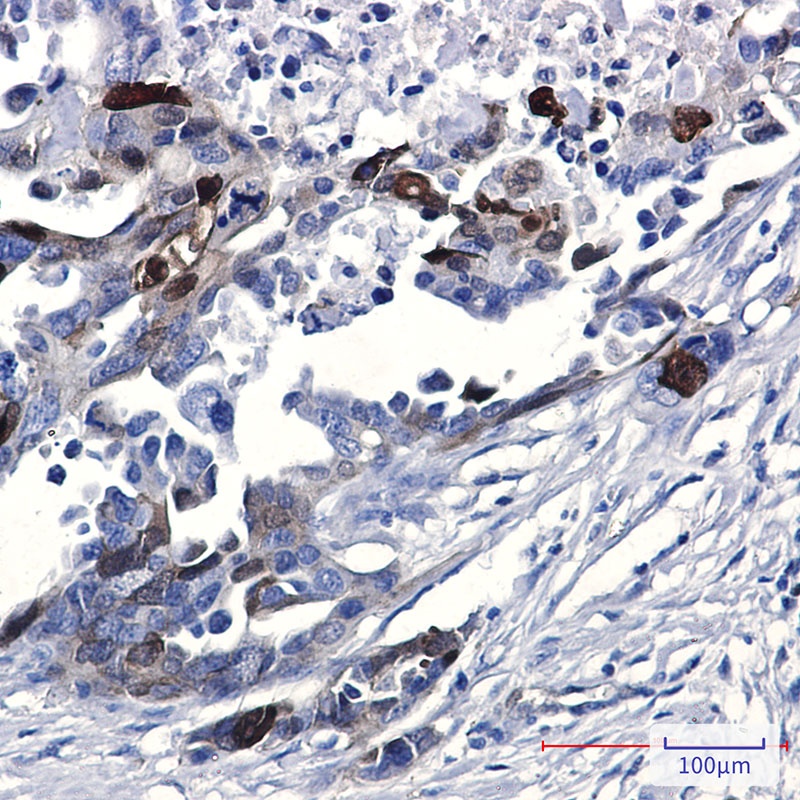 NDRG1 Antibody