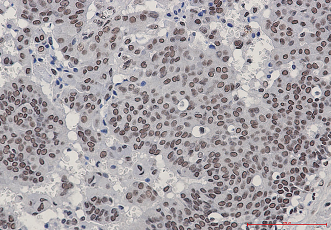 HSF1 Antibody