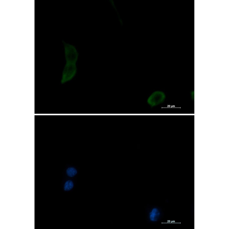 PAK1 Antibody