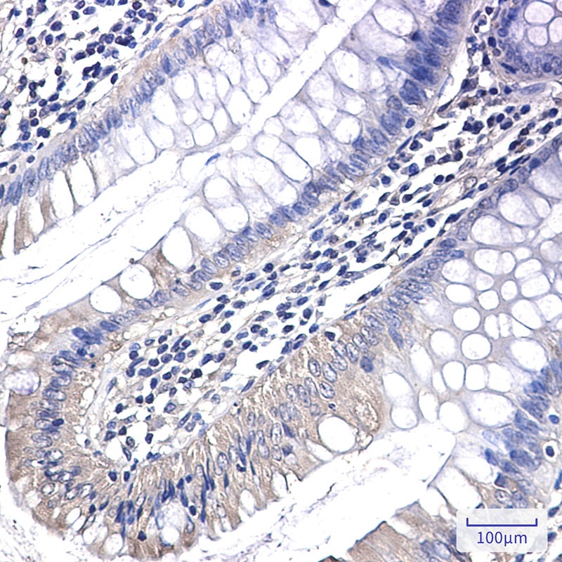 PAK1 Antibody