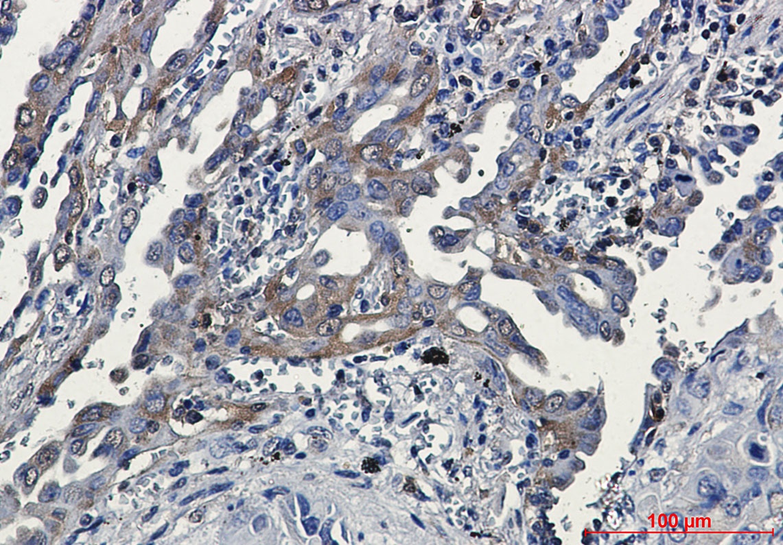 RSK3 Rabbit Monoclonal Antibody