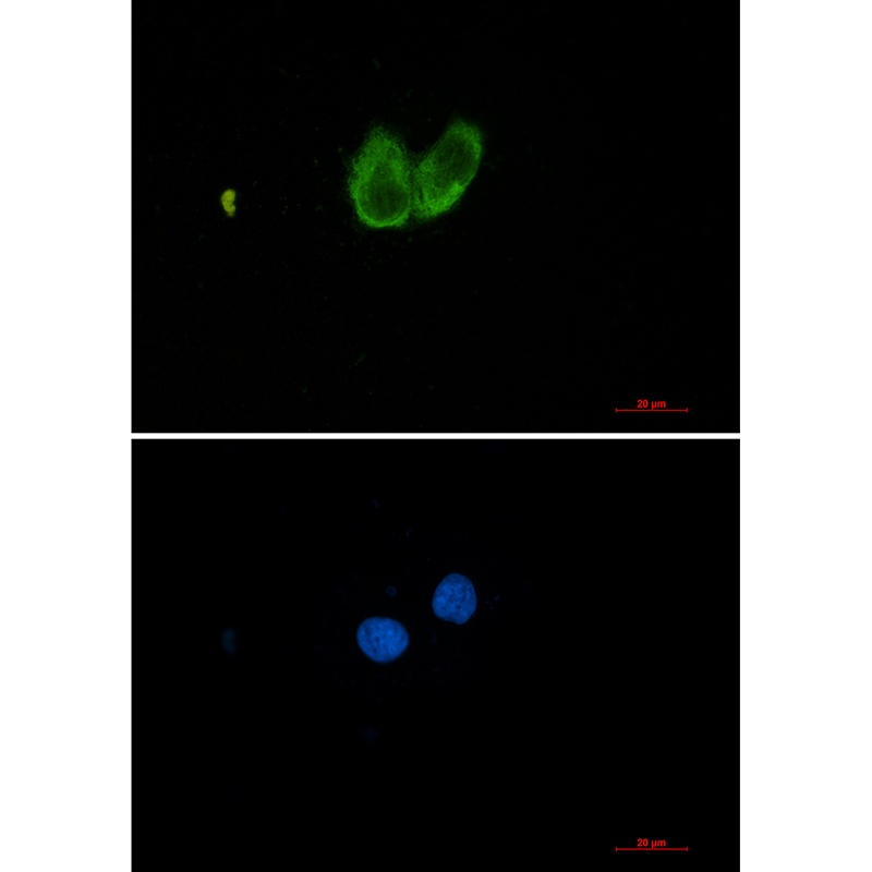 ZYX Antibody