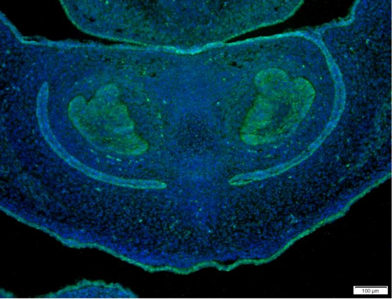 YAP1 Antibody
