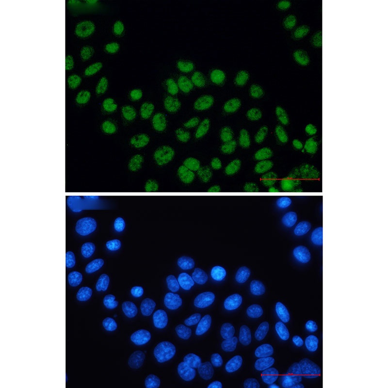 XPD Rabbit Monoclonal Antibody
