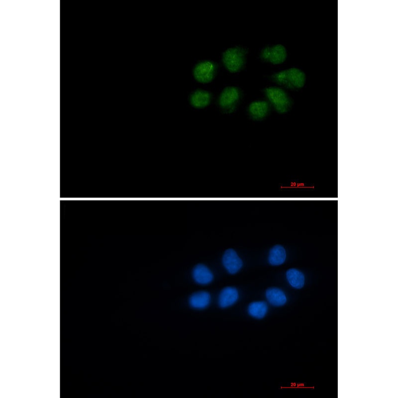 VIM Antibody