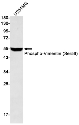 VIM Antibody