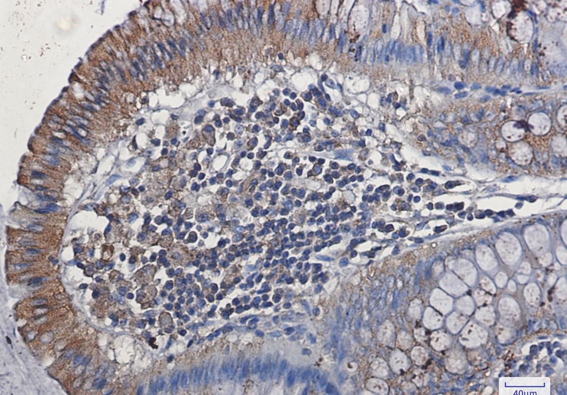 FLT1 Antibody