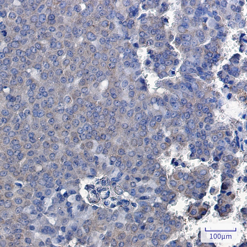 TXNDC9 Antibody
