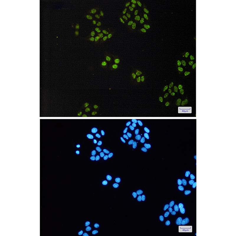 TAF15 Antibody