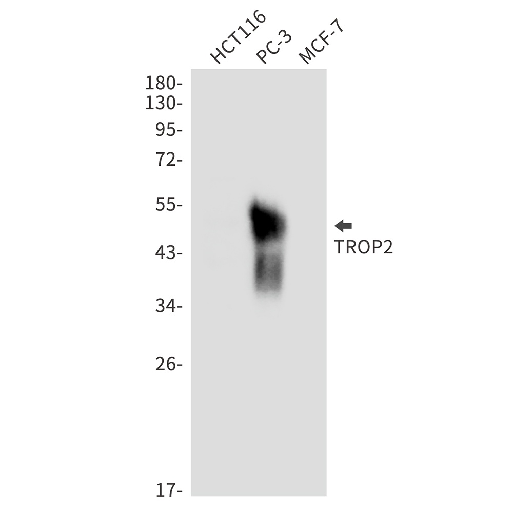 TACSTD2 Antibody