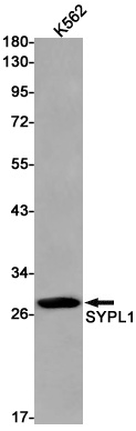 Synaptophysin Like Protein 1 Rabbit Monoclonal Antibody