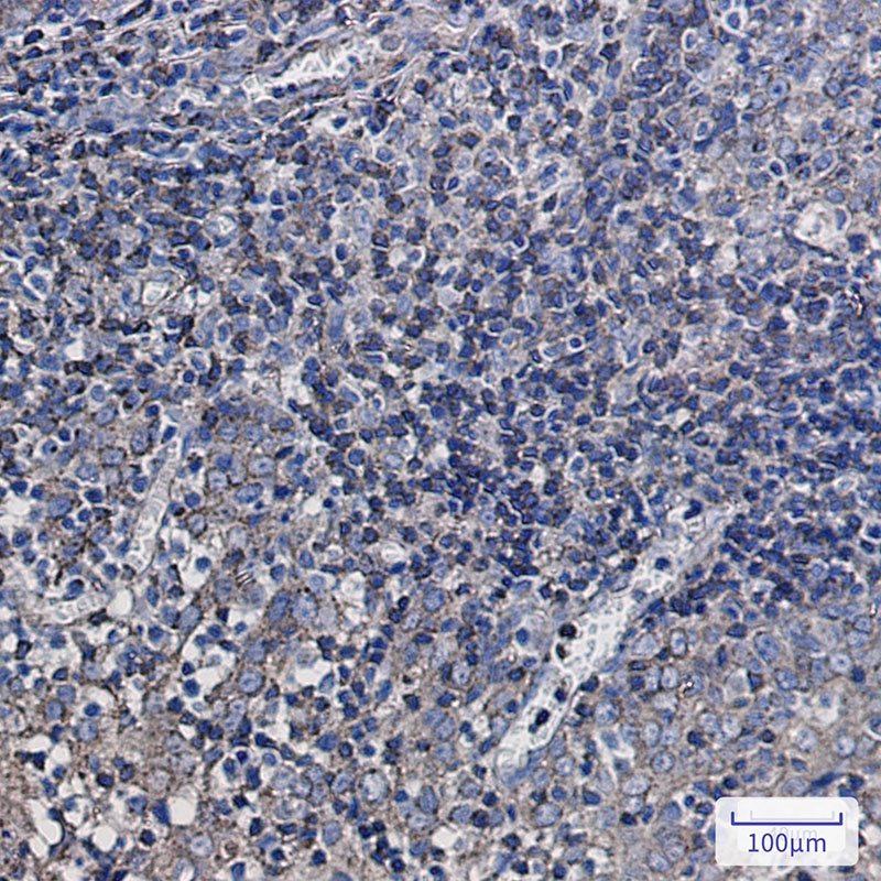 Synaptophysin Like Protein 1 Rabbit Monoclonal Antibody