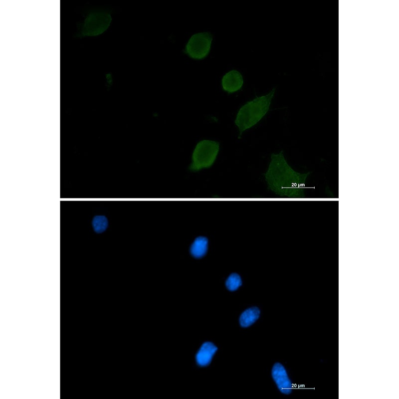 Synaptophysin Rabbit Monoclonal Antibody