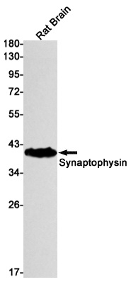 Synaptophysin Rabbit Monoclonal Antibody