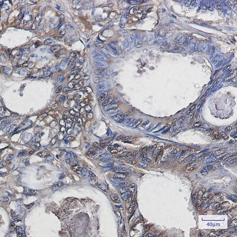 Superoxide Dismutase 1 Rabbit Monoclonal Antibody