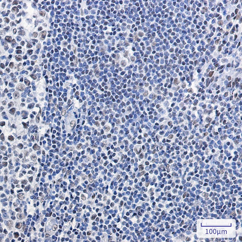 SNF5/SMARCB1 Rabbit Monoclonal Antibody
