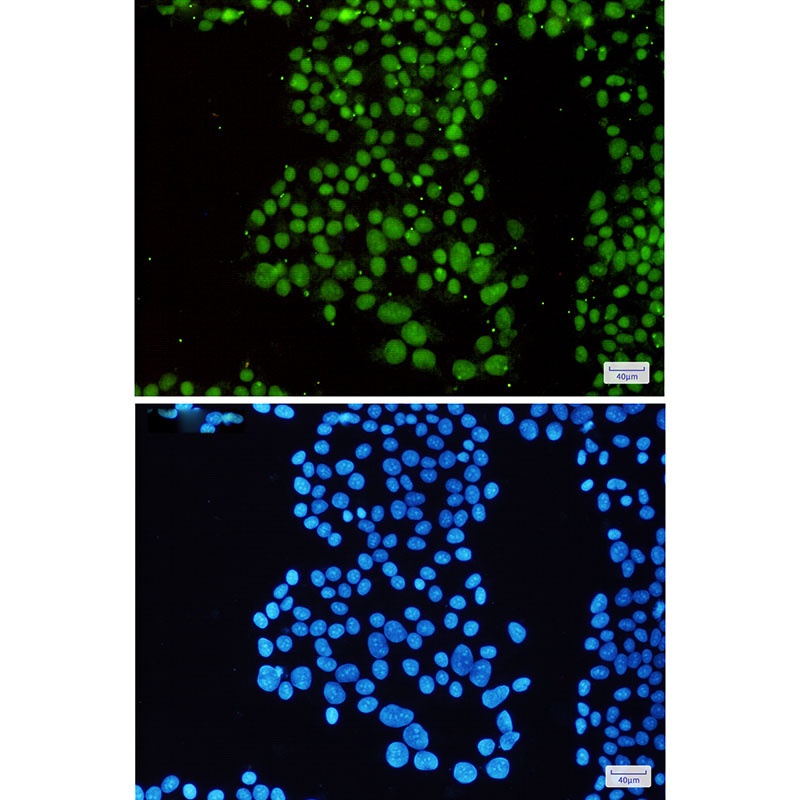 SNF5/SMARCB1 Rabbit Monoclonal Antibody