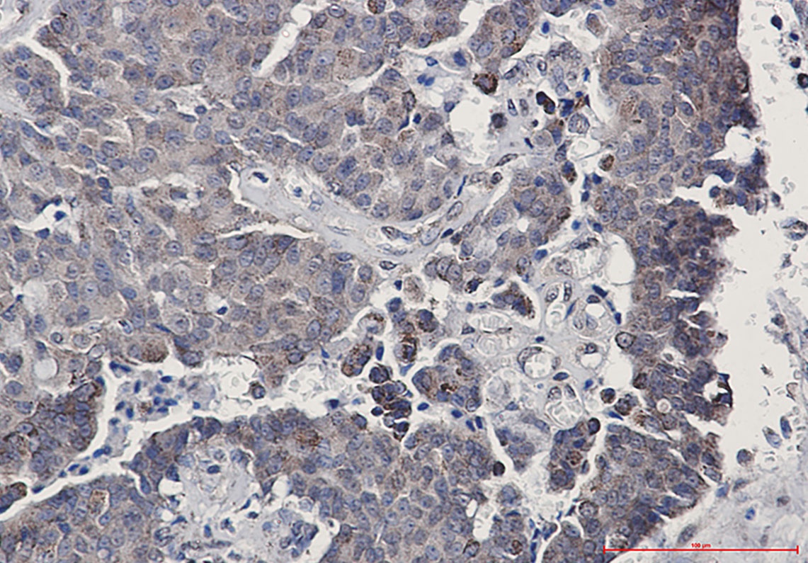 SIRT3 Antibody
