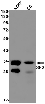 SF2 Rabbit Monoclonal Antibody
