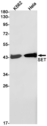 SET Rabbit Monoclonal Antibody