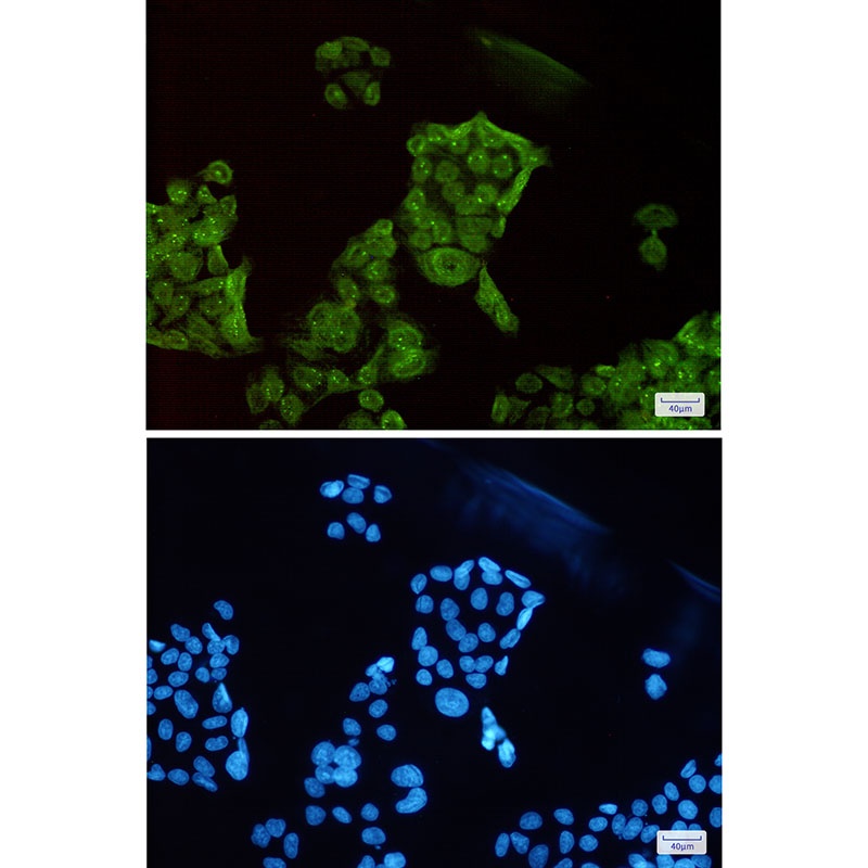 SET Rabbit Monoclonal Antibody