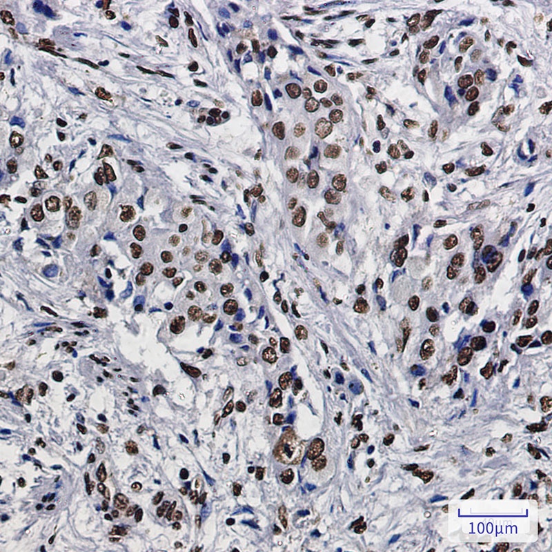 SET Rabbit Monoclonal Antibody