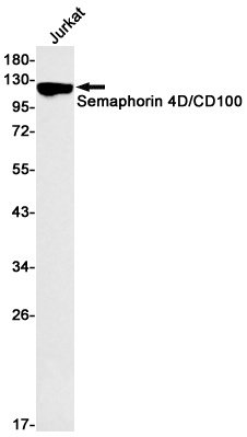 SEMA4D Antibody