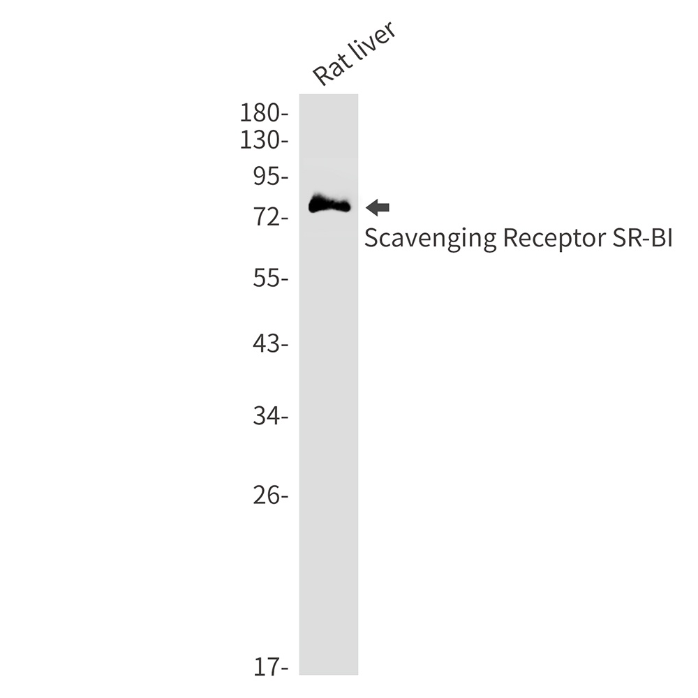 SCARB1 Antibody
