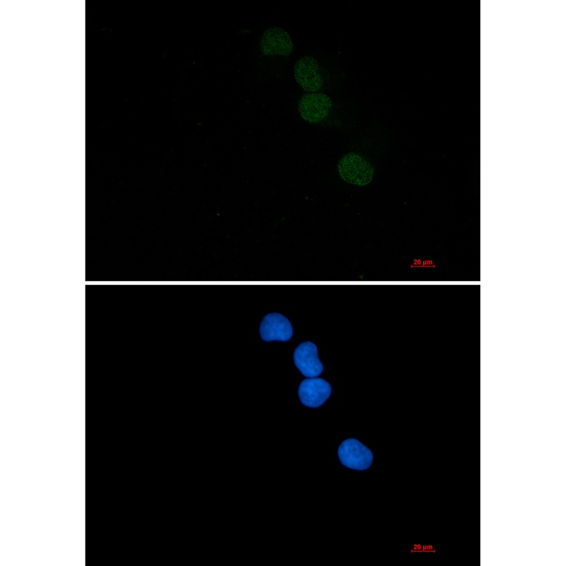 SAE1 Rabbit Monoclonal Antibody