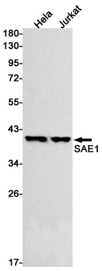 SAE1 Rabbit Monoclonal Antibody