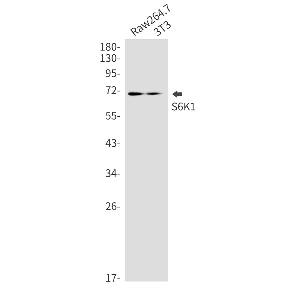 RPS6KB1 Antibody