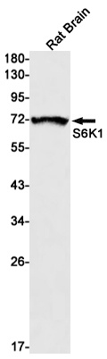 RPS6KB1 Antibody