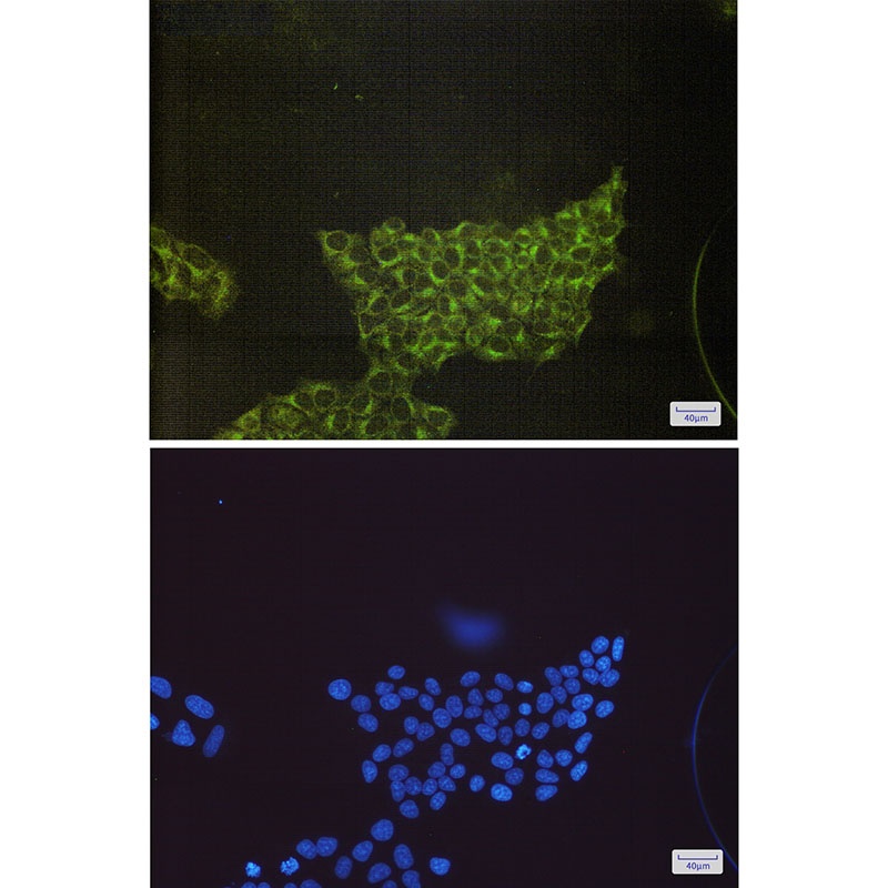 RPS6KB1 Antibody