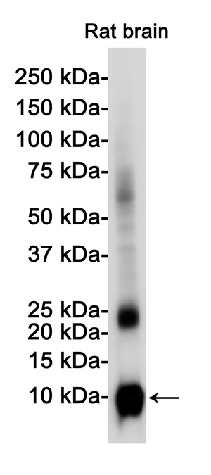 S100 beta Rabbit Monoclonal Antibody